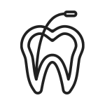 Endodoncia-Dentista-En-Tijuana-Zona-Rio-1